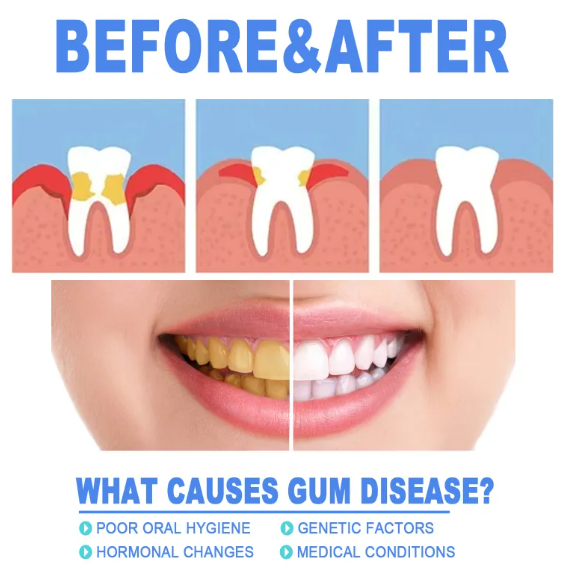 Gel reparador de dientes