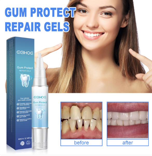 Gel reparador de dientes